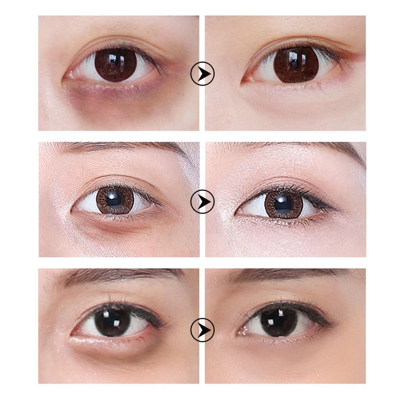 Anti-Aging Eye Cream