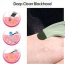 Blackhead and Whitehead Removal Tool for Nose and Face - Skin Pore Cleaner Skin Care Tools for Women